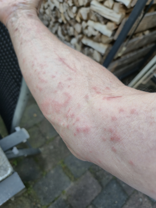 eikenprocessierups helaas